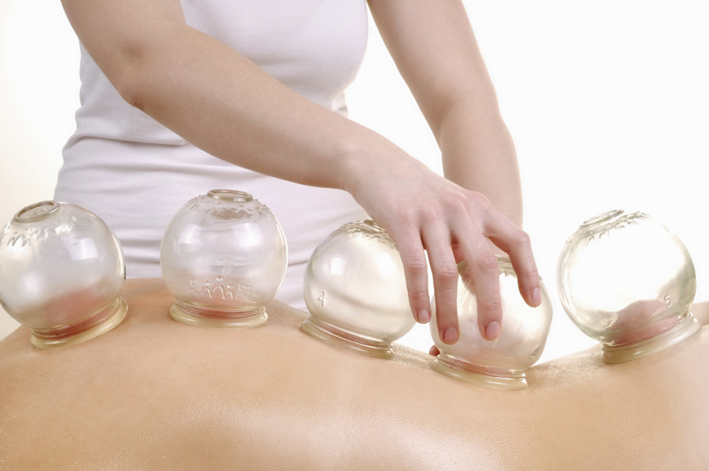 Glass cupping cups sitting on a patient's back